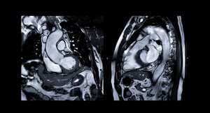 Magnetresonanztomografie (MRI) 